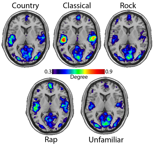音乐疗法，音乐疗法改善大脑功能的3种方法